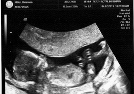 Baby at 14 weeks