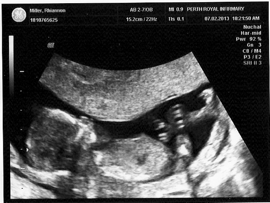 Baby at 14 weeks